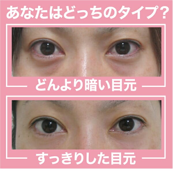 オムニ アイスラッククロフィートNEO 目元ケア たるみ 集中ケアの通販