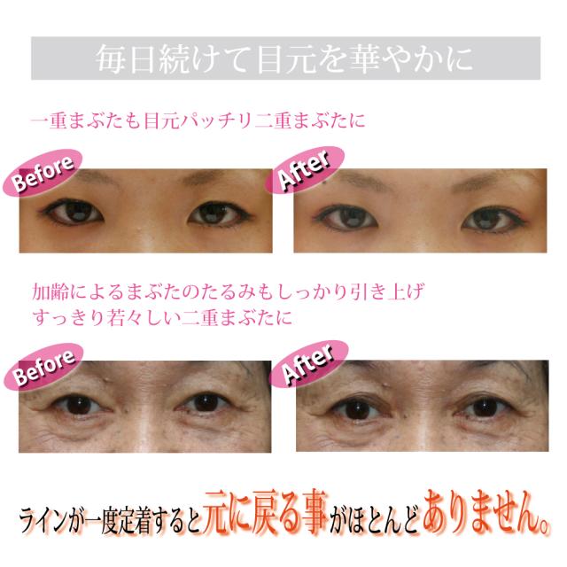 送料無料 二重まぶた形成器 Omni オムニ Newアイリッドフォールド Ymo 109 二重 クセ付け 一重 奥二重 ビューラー まぶた くせづけ アイの通販はau Wowma ワウマ M Trade 商品ロットナンバー