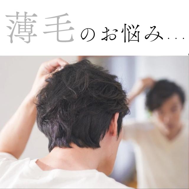薄毛のお悩み