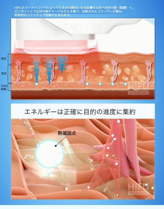 激安大特価 たるみ 抗しわ フィシャル ウルセラ 美容機器 Rfラジオ波 Hifu 家庭用hifu美顔器 最新型 小じわ高密度焦点式 肌の引き締め 超音波 美顔器 Revuemusicaleoicrm Org