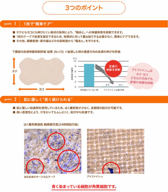 アトファイン ニチバン 帝王切開の傷 手術後 傷 傷あと ケアテープ