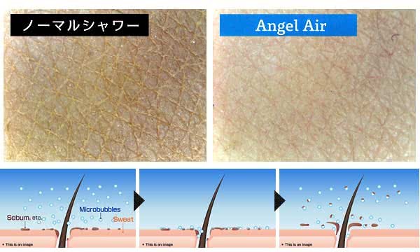 肌表面とマイクロバブルで毛穴の汚れを吸着