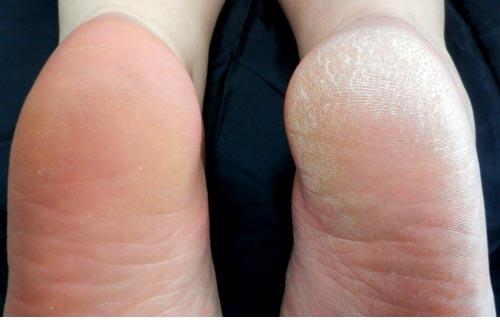 試してみました使った後の比較