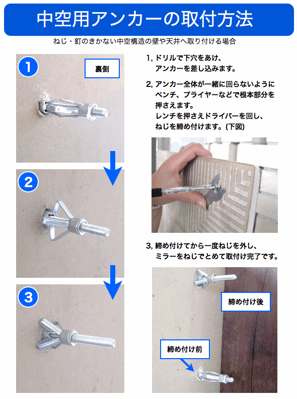 アンカーの取付方法
