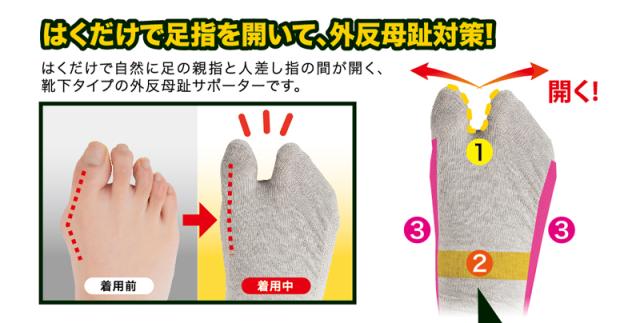 DrPRO 外反母趾ケアソックス 靴下　外反母趾 サポーター ソックス 外反母趾 靴下 改善 2本指ソックス 痛み緩和