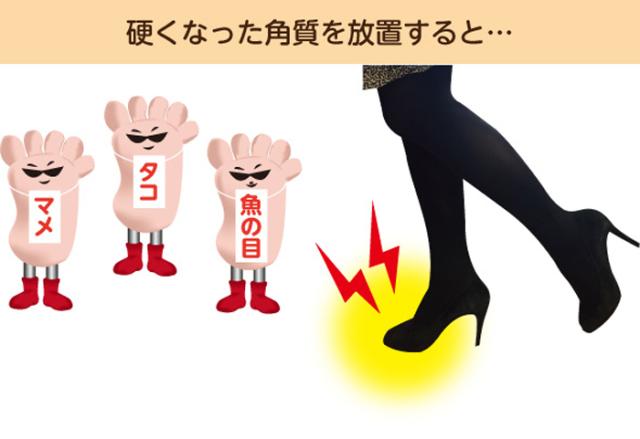 足裏用保湿パック まめノン 足裏 角質 足裏 角質除去 角質 除去 足 角質ケア 角質 かかと 角質 取り 角質取り 足 角質除去 ピーリングクリーム パック うおのめ 魚の目 ウオノメ 保湿 保湿クリーム 便利グッズ 便利アイテム 便利