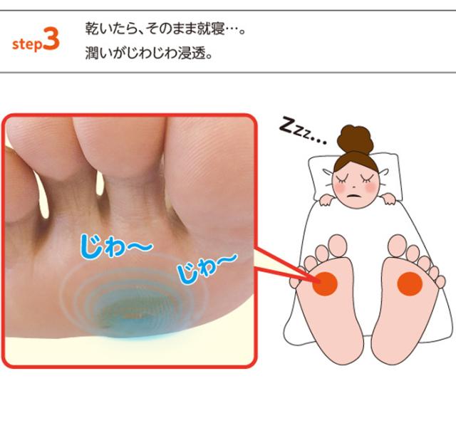 足裏用保湿パック まめノン 足裏 角質 足裏 角質除去 角質 除去 足 角質ケア 角質 かかと 角質 取り 角質取り 足 角質除去 ピーリングクリーム パック うおのめ 魚の目 ウオノメ 保湿 保湿クリーム 便利グッズ 便利アイテム 便利