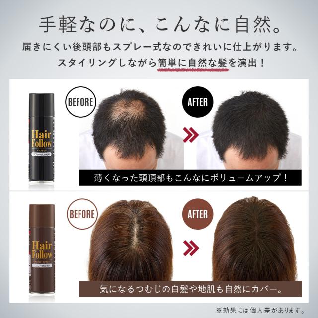 ヘアスプレー ヘアフォロー 増毛スプレー ボリュームアップ 白髪かくし 薄毛カバー 薄毛対策 メンズ レディースの通販はau Pay マーケット アイメディアwebshop 商品ロットナンバー