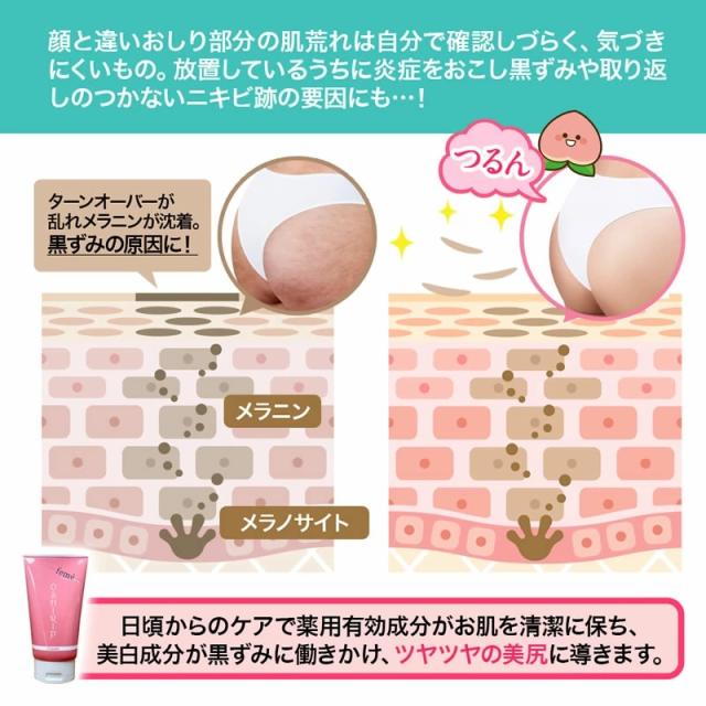 おしりクリーム 黒ずみ ツブツブ