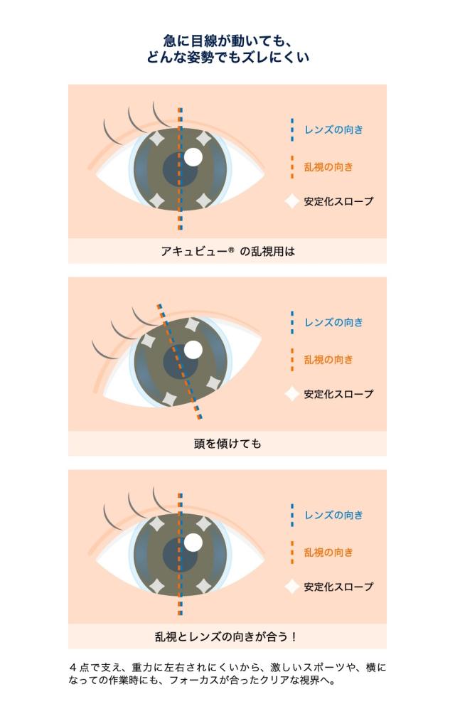 1day-av-oasys-max-tc