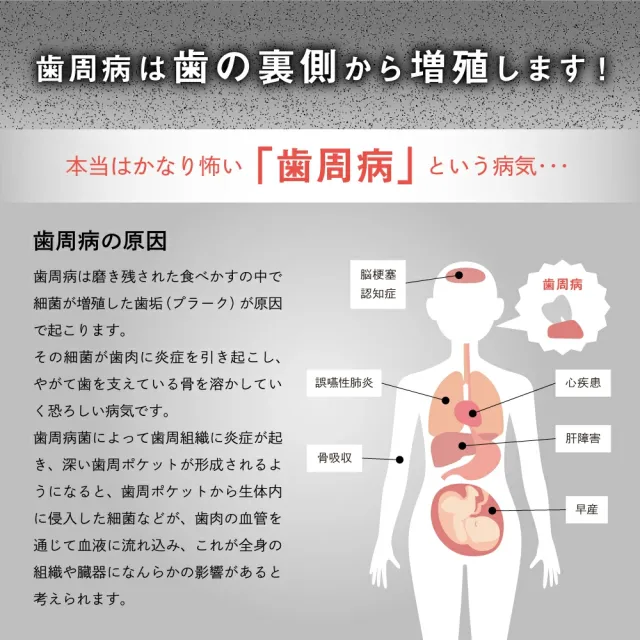 歯周病について