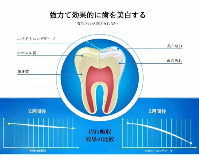 送料無料 」7セット14枚 歯に貼るホワイトニングシート 3D ホワイト トゥースホワイトニングストリップス 歯のホワイトニング 歯 美白  の通販はau PAY マーケット - 電子部品商店 au PAY マーケット店