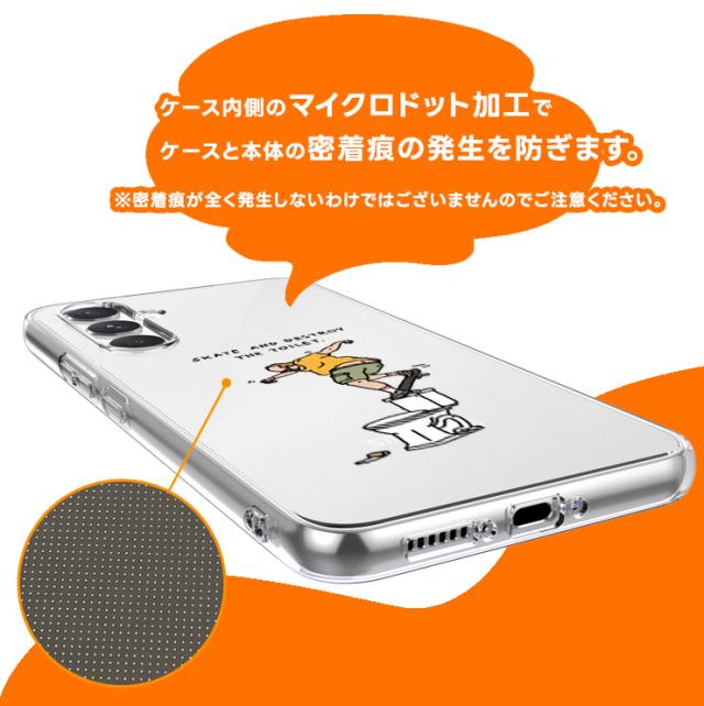 マイクロドット加工 密着痕 防ぐ 本体