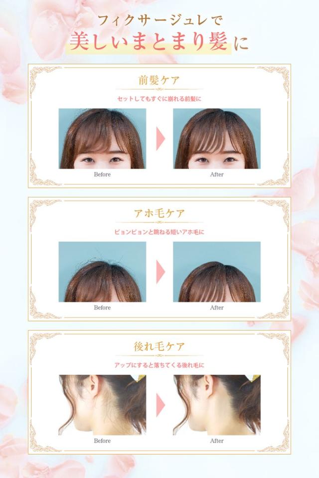 STコンテ フィクサージュレ CFJ1300