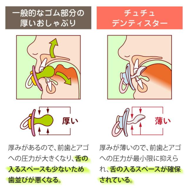 一般的なゴム部分の厚いおしゃぶりとチュチュデンティスターの違い