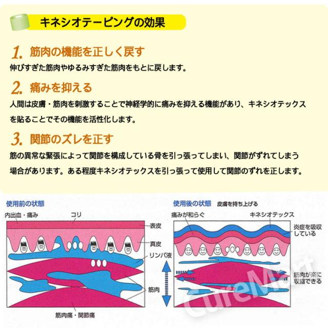 キネシオテープ