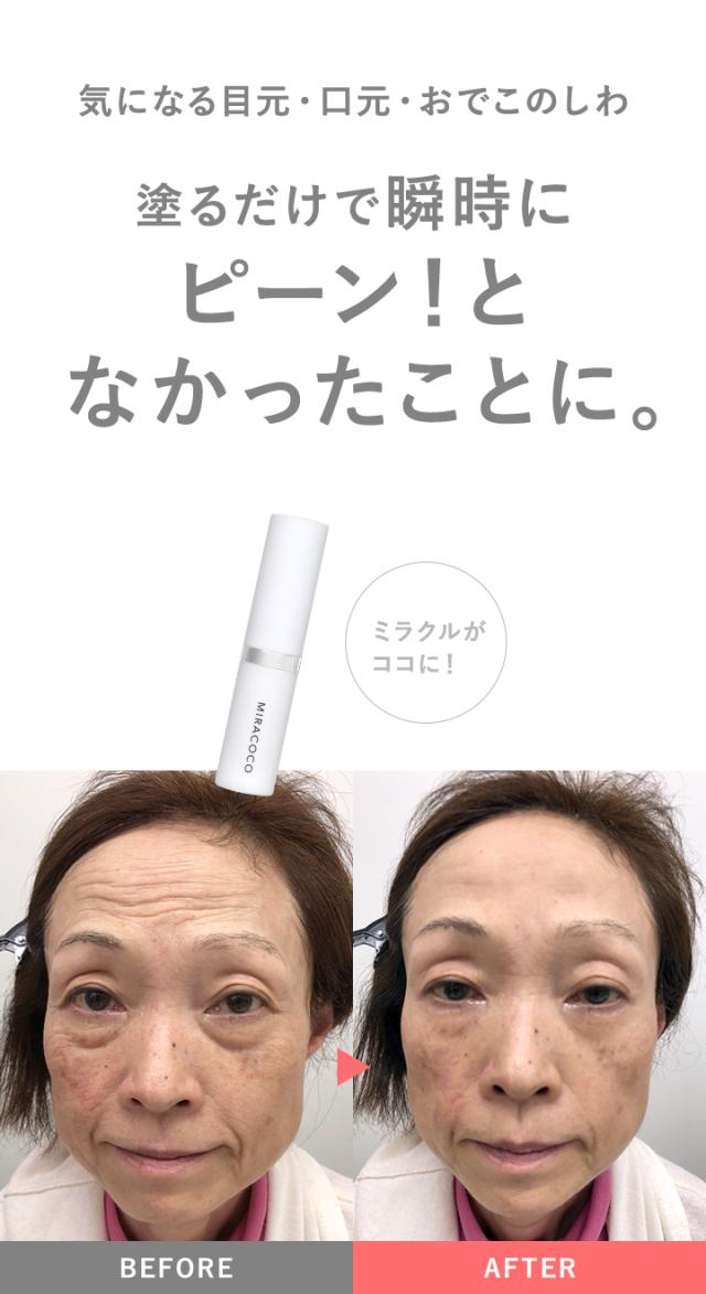 アイクリーム ファンデーション
