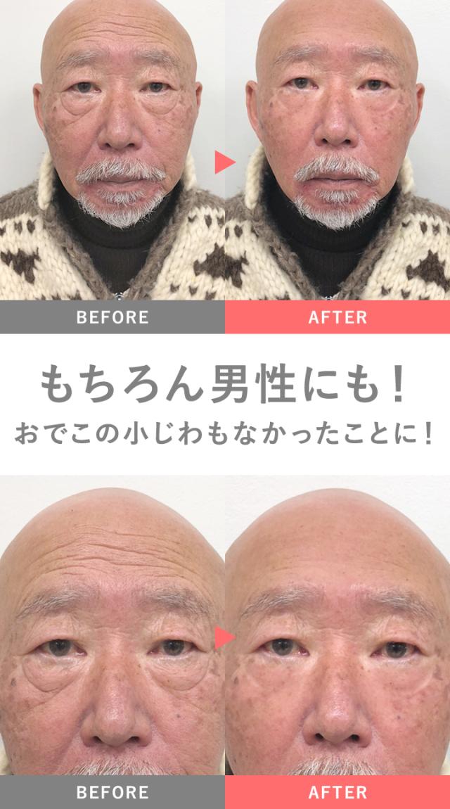 アイクリーム ファンデーション