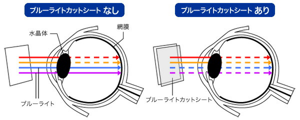 OverLay Eye Protector の詳細