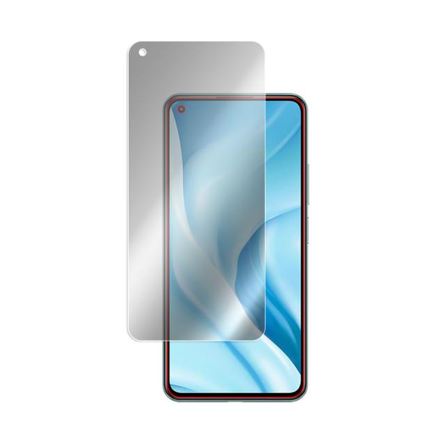 Xiaomi Mi 11 Lite 5G 液晶保護シート