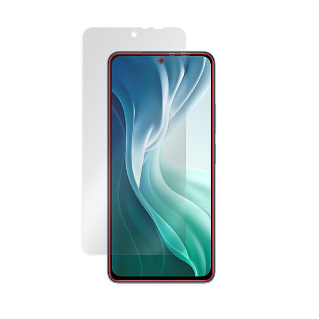 Xiaomi Mi 11i 液晶保護シート