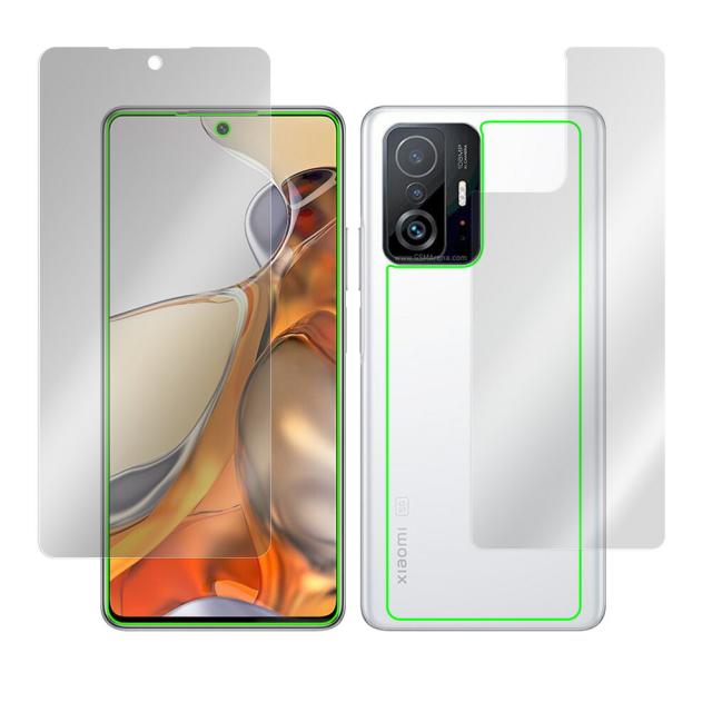 Xiaomi 11T Pro / Xiaomi 11T 表面・背面セットの保護シート