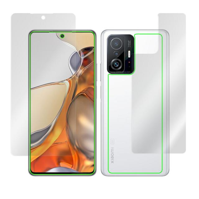 Xiaomi 11T Pro / Xiaomi 11T 表面・背面セットの保護シート
