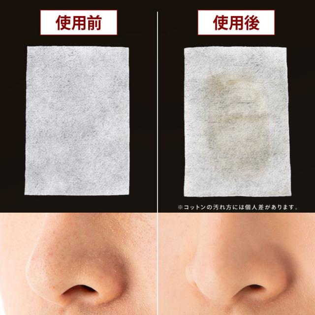 EMS美顔器 多機能美顔器 美顔器 EMS イオン導出 イオン導入 マイクロカレント