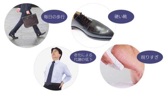 毎日の歩行・硬い靴・老化による代謝の低下・削りすぎ
