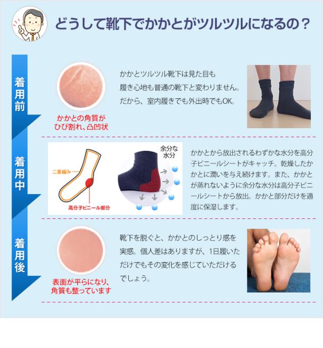 どうして靴下でかかとがツルツルになるの？