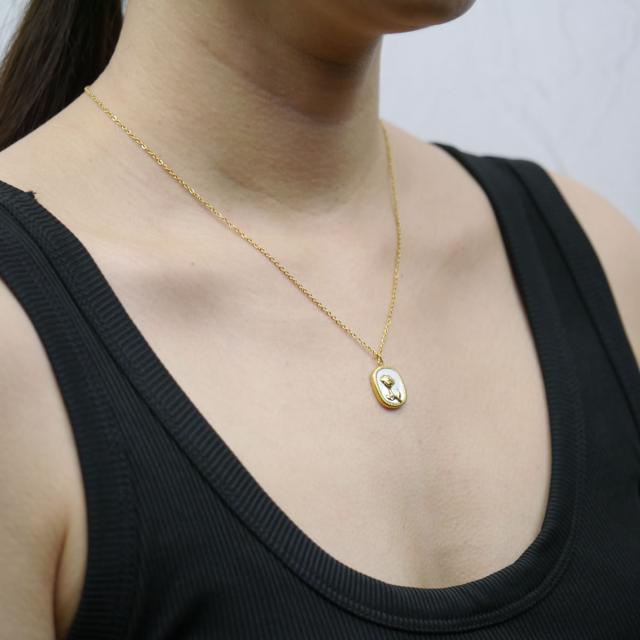 サージカルステンレス