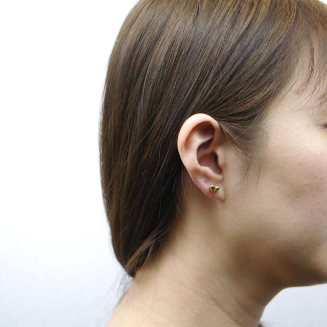 サージカルステンレス