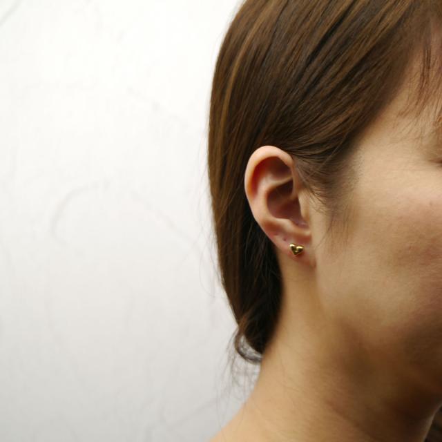 サージカルステンレス