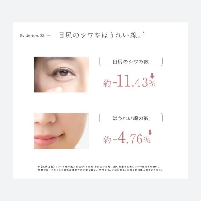 《 おまけ付 》 美顔器 LOABI ロアビ Espelia エスペリア おまけ付き エステ機器 超音波美顔器 ems ラジオ波 家庭用 目元 毛穴ケア 目元ケア イオン導入 led トーンアップ リフトアップ ems 美肌 スキンケア ホーム 自宅 エステ ケア ボディケア ほうれい線 イオン導入