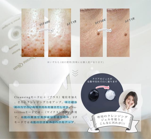 全品ポイント5％UP！21日23:59迄◇《送料無料》プラソニエ アクア毛穴クリーン / KC324 イノベイション株式会社 美顔器  超音波 角質除去 美肌 毛穴ケア