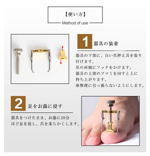 2個セット 収納ボックス付き 巻き爪 矯正 器具 陥入爪 矯正 ネイルケア