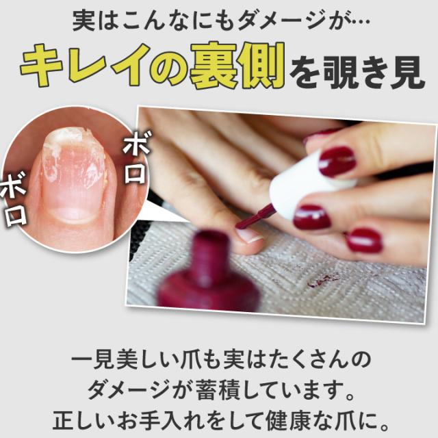 実はこんなんもダメージが キレイの裏側を覗き見