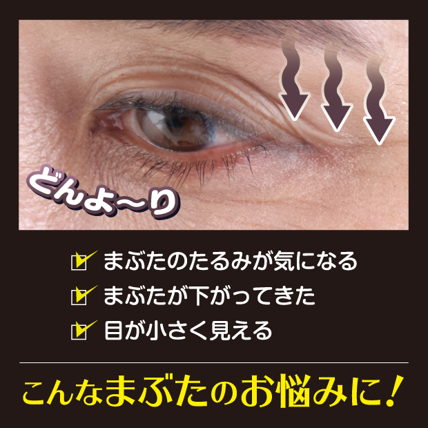 こんなまぶたのお悩みに
