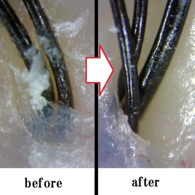 頭皮 汚れ を ディープクレンズ