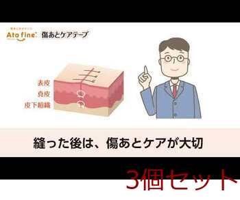 ニチバン アトファイン 傷あとケアテープ Mサイズ 3枚入 3セット 送料無料-3