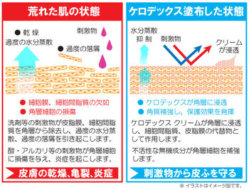 ケロデックスクリーム チューブタイプ 100g 2個セット 送料無料-4